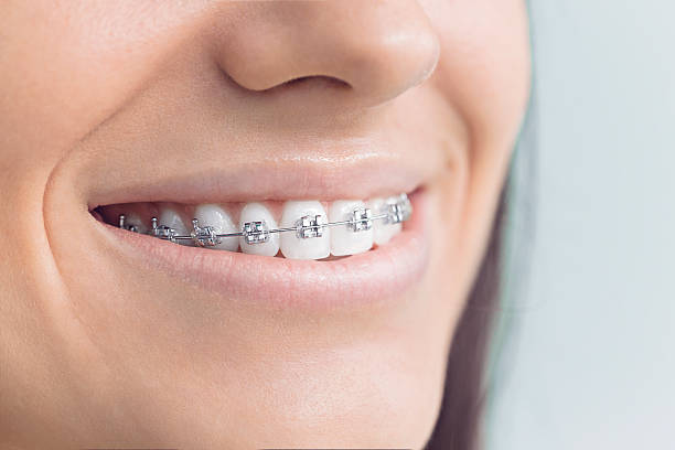 Best Dentures (Full and Partial)  in Ridgway, CO